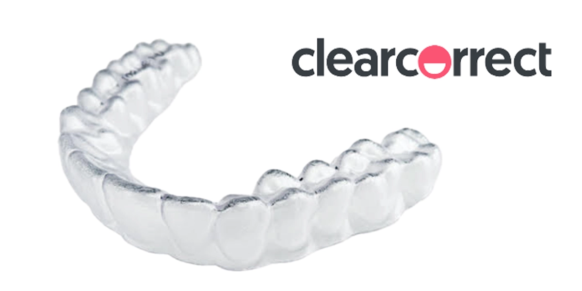 マウスピースによる部分矯正