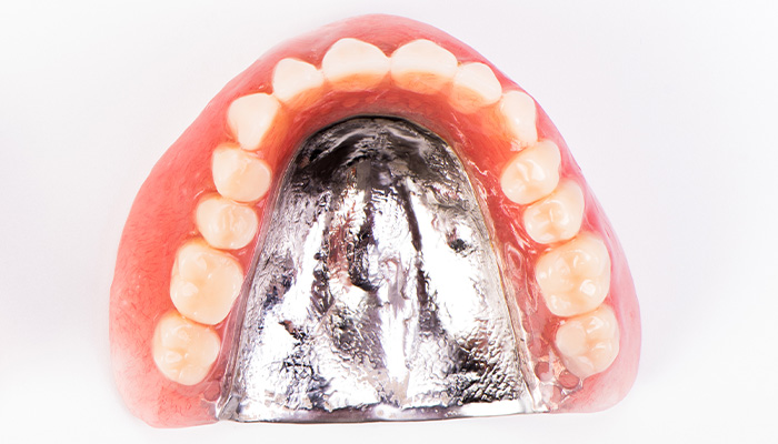 金属床義歯（総入れ歯